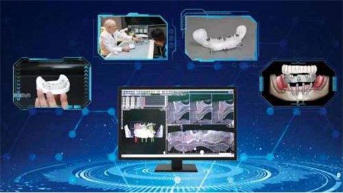 口腔种植手术导航定位系统同品种临床评价注册审查指导原则（2021年第93号）(图1)